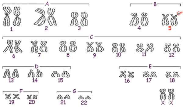 Alterações e síndromes cromossômicas: aneuploidia, euploidia e inversão
